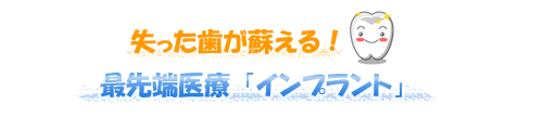 インプラント治療のご案内