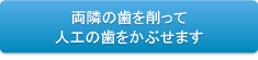 両隣の歯を削って人工の歯をかぶせます