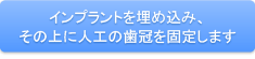 インプラントを埋め込み、その上に人工の歯冠を固定します