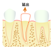 拙出