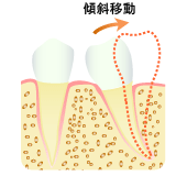 整直