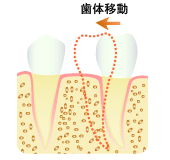 歯体移動